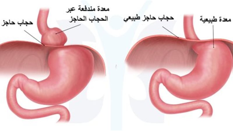 هير نيوز