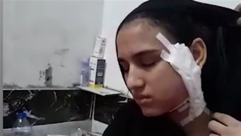 هير نيوز