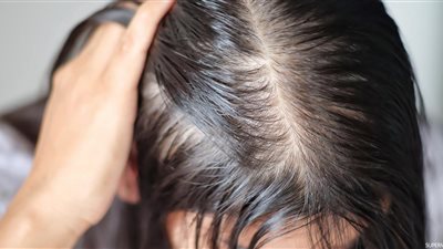 «لو شعرك خفيف».. احذري 3 عادات يومية تُسبب كارثة 