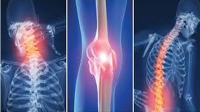 أسباب وأعراض خشونة المفاصل وطرق علاجها