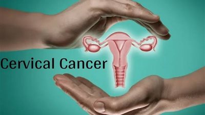 4 أسباب غير متوقعة تعرضك لسرطان عنق الرحم.. أعرفيها 