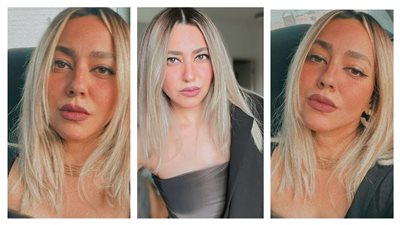 بعد إزالة شامتها.. هند عبد الحليم تفاجئ الجمهور بنيولوك (صور)