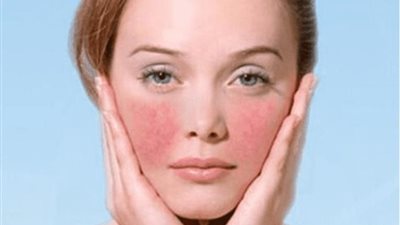 بعد إصابة الفنانة روجينا.. نصائح هامة لحماية الجلد من حروق الشمس 