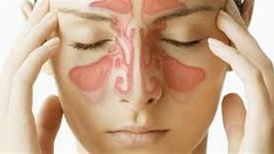 8 أعراض للالتهاب الجيوب الأنفية الحاد 
