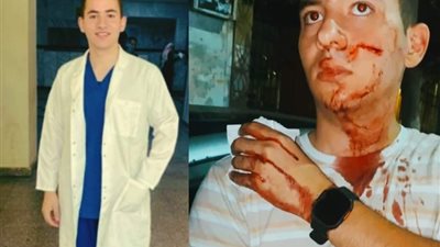 هاشتاج حق الدكتور عثمان فين يكتسح «إكس» بعد التعدي عليه بالسلاح الأبيض 