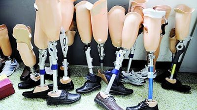 صندوق عطاء يسلم 232 طرفا صناعيا للطلاب والأشخاص من ذوي الإعاقة