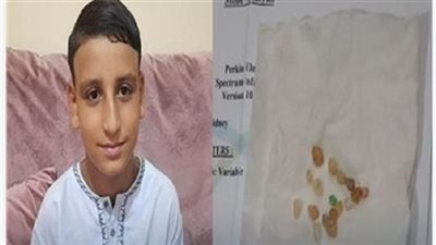 قصة ولا في الخيال.. طفل يتبول أحجار كريمة في كفر الشيخ ويتصدر التريند 