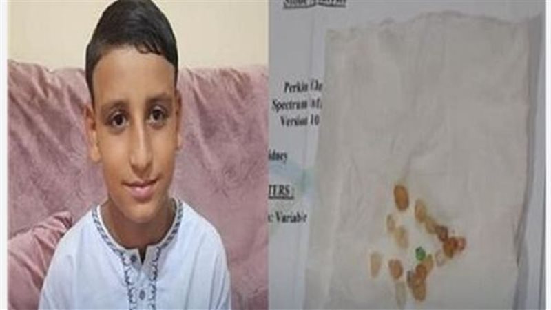 طفل يتبول أحجار كريمة