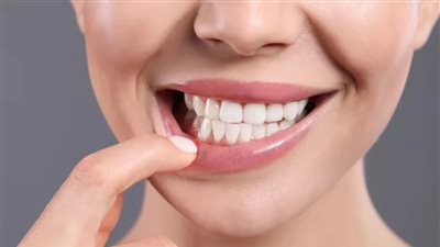 لتخفيف الألم.. 6 علاجات منزلية للتخلص من حروق الفم 