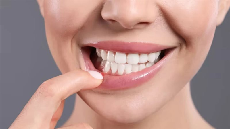 علاج حرق الفم