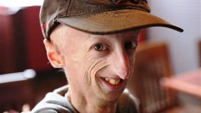 وفاة سامي باسو الأطول عمرًا بالشيخوخة المبكرة في إيطاليا 