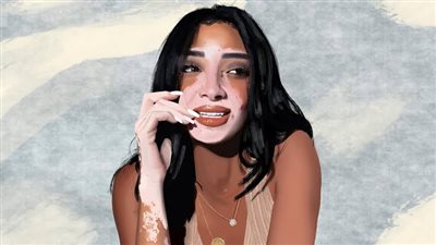 بعد فوزها بملكة جمال مصر 2024.. لوجينا صلاح تكشف أسرار رحلتها مع البهاق 