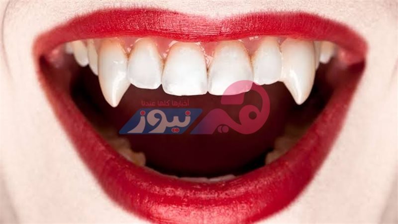 أنياب مصاصي الدماء