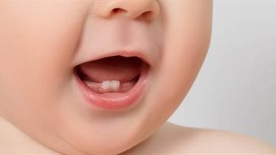 القومي للبحوث يكشف لـ «هير نيوز» 6 طرق لحماية أسنان طفلك من التسوس