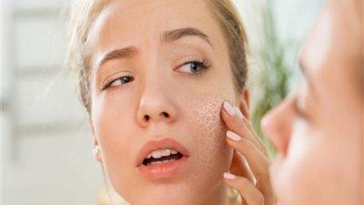 في الشتاء.. نصائح شائعة لحماية الجلد من الجفاف 