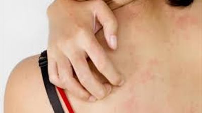 تفسير حلم الهرش في المنام وعلاقته بالمال