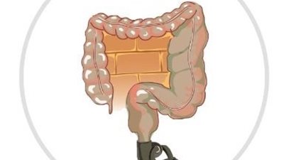مشروبات طبيعية تساعدك في التخلص من الامساك 