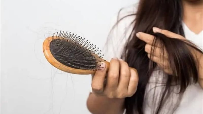 تساقط الشعر لدى الفتيات