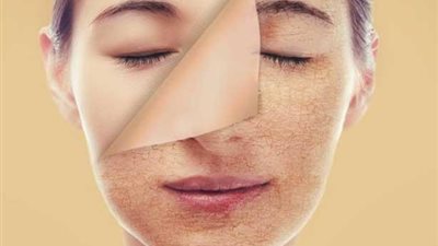 تخلصي من جفاف البشرة في الشتاء بهذه النصائح