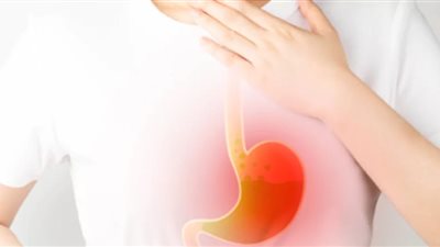 لمرضى ارتجاع المريء.. «الصحة» تحذر من تناول هذه الأطعمة