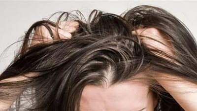 5 علاجات منزلية للتخلص من فروة الشعر الجافة  