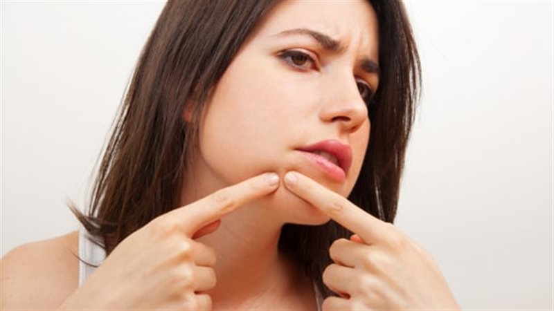 أسباب وعلاج حب الشباب