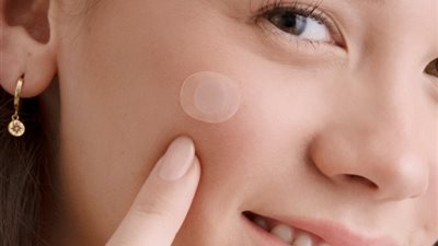 هل تعتبر لاصقات السيليكون لعلاج حب الشباب في الوجه خيارًا آمنًا للبنات؟