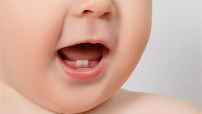 آلام التسنين
