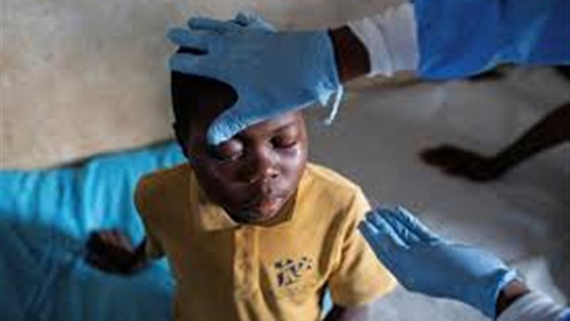 مرض الكونغو