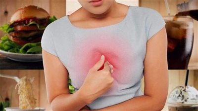 لو بتعاني من الحموضة في العيد.. إليك 5 نصائح يجب اتباعها 