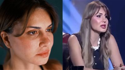 نجلاء بدر تظهر بوجه جديد والجمهور في حالة صدمة (صور) 