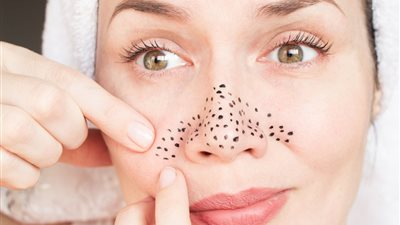 لبشرة نقية.. 5 طرق فعّالة لإزالة الرؤوس السوداء من الأنف 