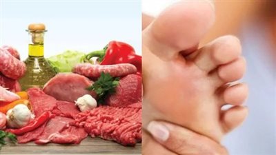 نصيحة مهمة من القومي للبحوث بشأن الغذاء خلال عيد الأضحى