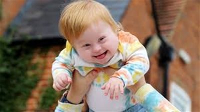 كيف تتجنبين ولادة طفل مصاب بمتلازمة داون؟