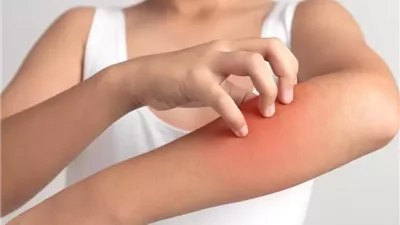 وزارة الصحة: الإجهاد النفسي المتكرر يؤثر على الأمراض الجلدية