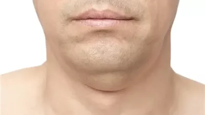 دراسة: محيط الرقبة 17 للرجال و14 للنساء ينذر بالخطر