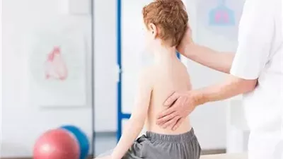 ما هو مرض الجنف عند الأطفال.. وأفضل علاج