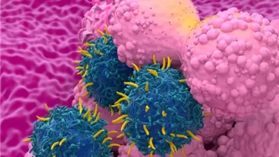 اللحوم المصنعة تهددك بسرطان الثدي.. احذريها