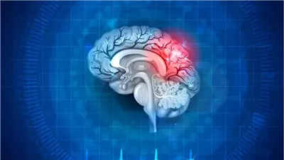  7 علامات مبكرة تنذر بورم الدماغ.. منها صعوبة نطق الكلمات 