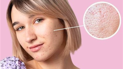 لمظهر ناعم وأملس.. 7 خطوات لإخفاء المسام الواسعة