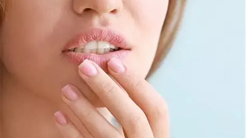 جفاف الشفاة 