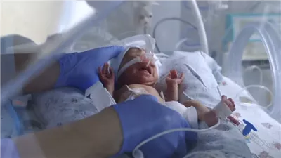 الولادة المبكرة... لماذا تحدث وكيف تؤثر على صحة المولود؟