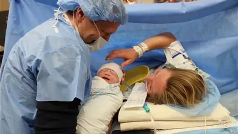 الولادة القيصرية 