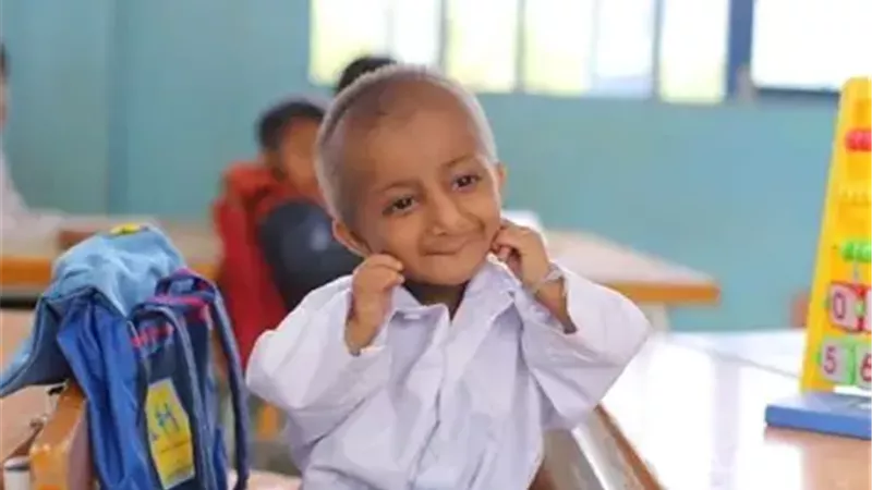 متلازمة سيكل 