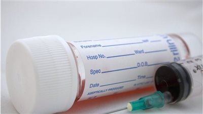 وزارة الصحة تحذر: حقن البرد خلطات قاتلة تؤدى للوفاة