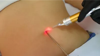 استطلاع: إرضاء الزوجة يدفع رجالا لتفتيت دهون البطن