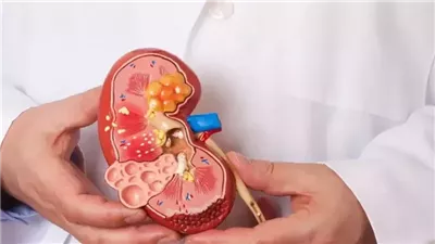 الصحة توجه إرشادات لمرضى القلب والكلى لصيام آمن في رمضان: استشارة الطبيب أساسية