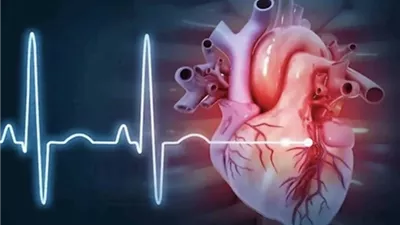 دراسة: النساء أقل حظا في علاجات القلب المتقدمة
