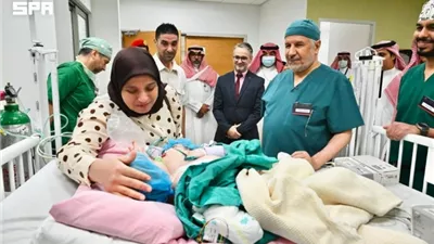 بدء عملية فصل التوأم الملتصق المغربي «سجى وضحى» بالرياض