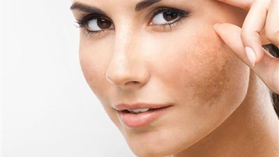 كيف يمكنكِ التعامل مع البقع السوداء في البشرة؟.. خبير تجميل يُجيب 